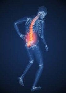 back pain at work
